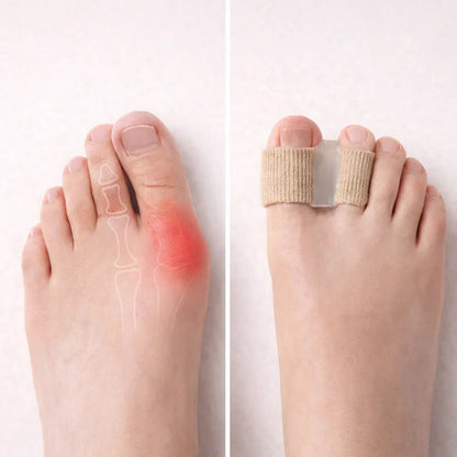 Zehenspreizer bei Hallux Valgus – Schmerzlinderung & Ausrichtung (1 Paar)