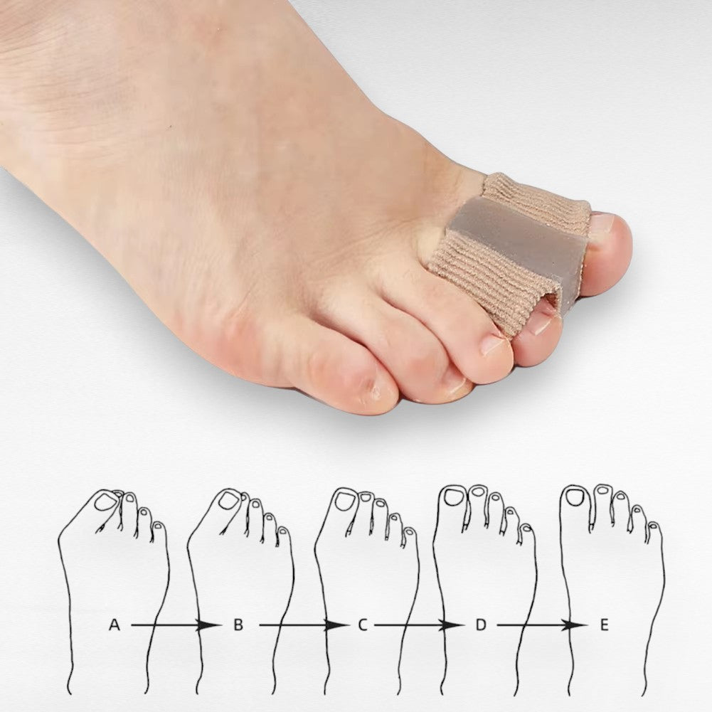 Zehenspreizer bei Hallux Valgus – Schmerzlinderung & Ausrichtung (1 Paar)