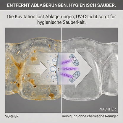 Ultraschallreiniger für Zahnspangen und Aligner mit UVC-Lampe, 42 kHz, Zyklus 5 oder 10 Minuten
